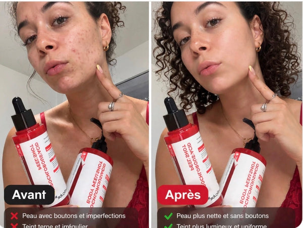 Exfoliation en douceur